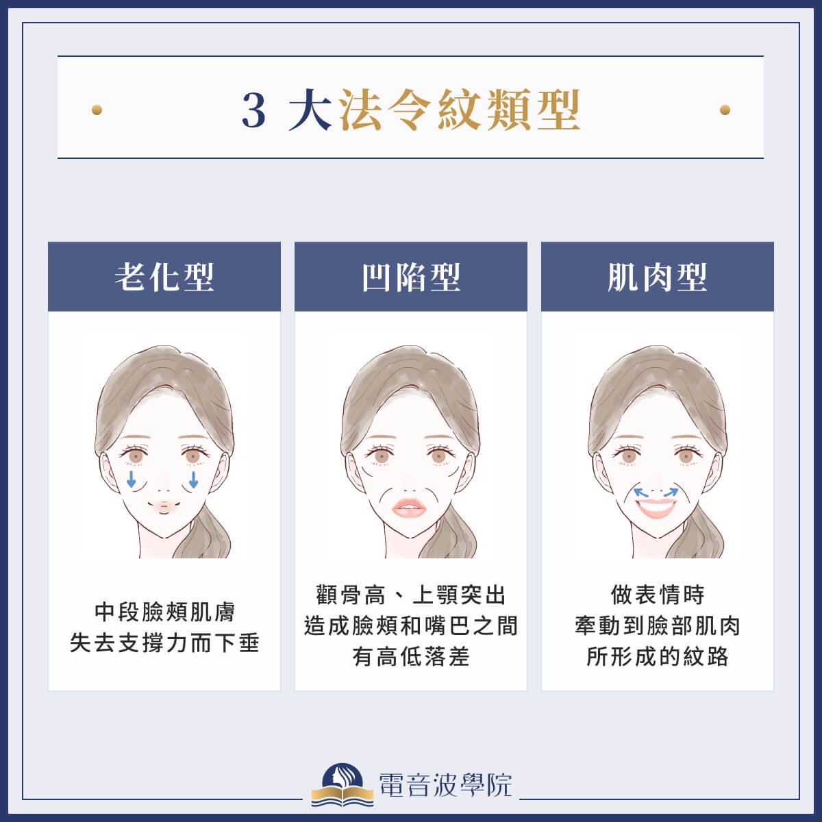 法令做什麼療程填充比較好?