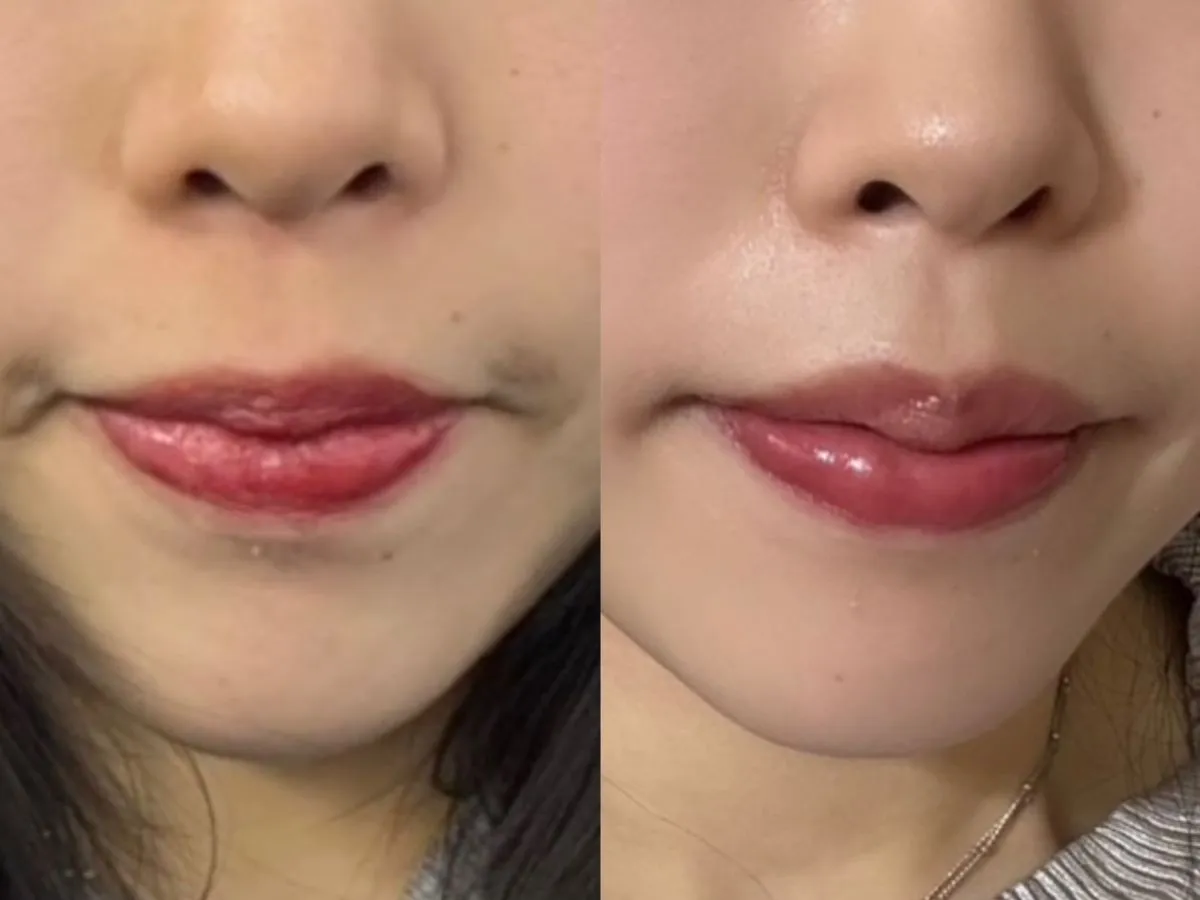 #分享 終於有跟趙露思一樣好看的嘟嘟唇