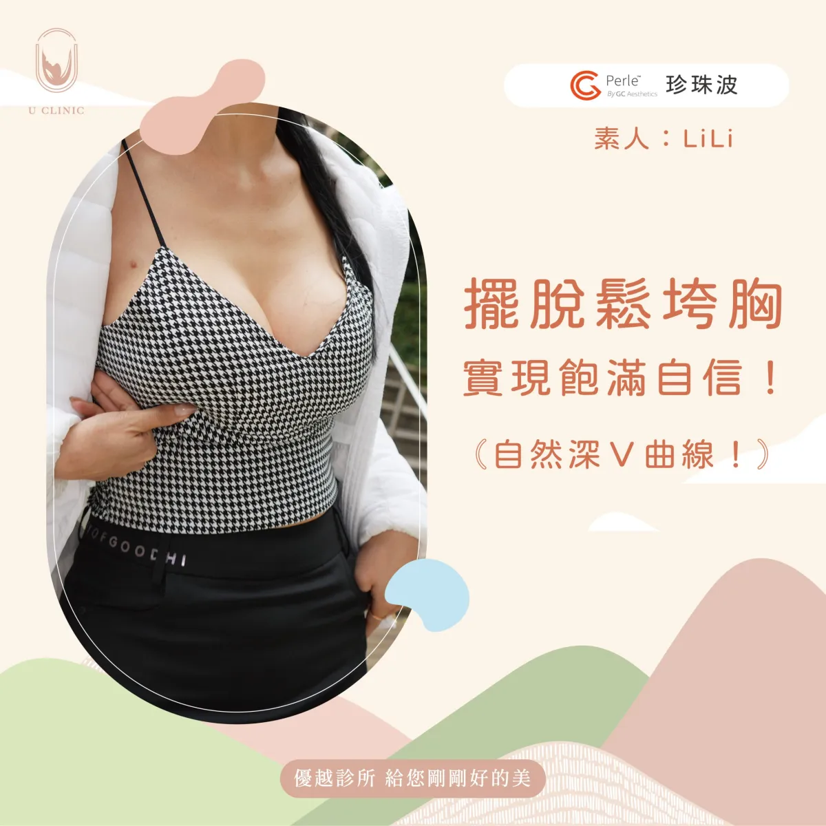 北部隆乳診所怎麼選 想找自然又比較不用按摩的材質